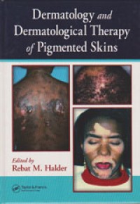 DErmatology and Dermatological Therapy of Pigmented Skins