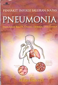 Penyakit Infeksi Saluran Napas Pneumonia