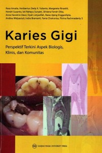 Karies Gigi: Perspektif Terkini Aspek Biologis, Klinis, dan Komunitas