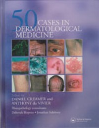 Image of 50 Cases in Dermatological Medicine