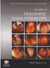 Image of An atlas of Diagnostic Nasal Endoscopy