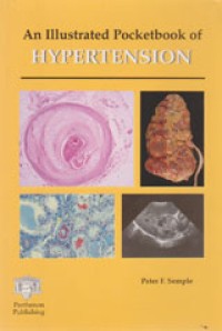 Image of An Illustrated Pocketbook of Hypertension