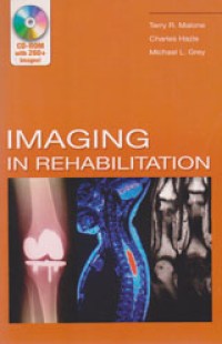 Image of Imaging In Rehabilitation