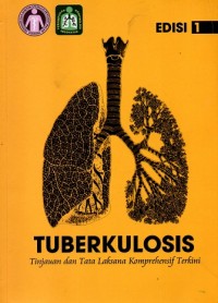 Image of Tuberkulosis: Tinjauan dan Tata Laksana Komprehensif Terkini Edisi 1