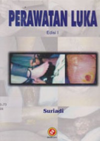 Image of Perawatan Luka