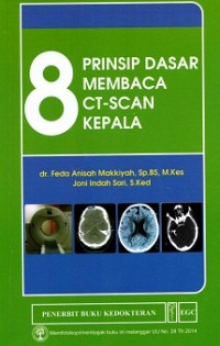 Image of 8 Prinsip Dasar Membaca CT-Scan Kepala
