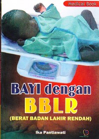 Image of Bayi dengan BBLR
